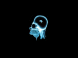 Radiografia del cervello di Homer Simpson